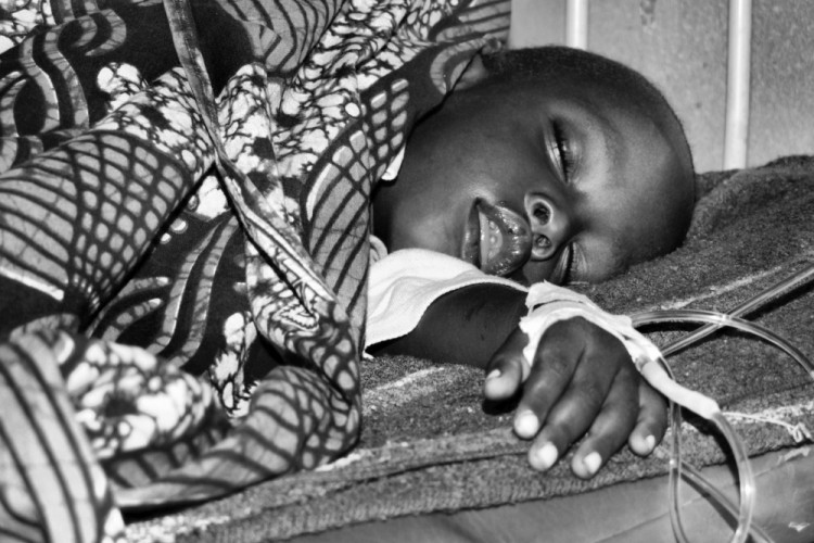 MALARIA